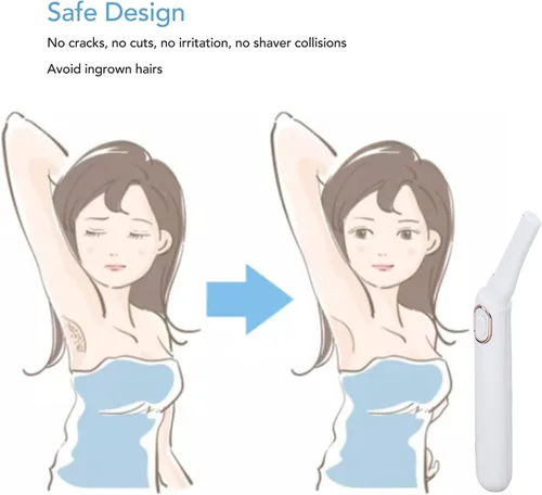 Vista 6 de Afeitadora eléctrica para mujer, afeitadora de bikini de uso en seco, ajuste en ángulo, afeitadora eléctrica con luz LED para mujer, para cara