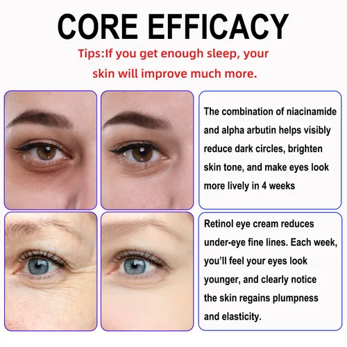 Vista 4 de Crema de ojos de retinol con niacinamida, ácido hialurónico y vitamina E – Suero hidratante debajo de los ojos para ojeras visibles, apariencia