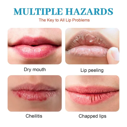 Vista 5 de Labios secos y agrietados, bálsamo labial curativo natural, crema orgánica para tratamiento de queilitis humectante durante todo el día, hombres