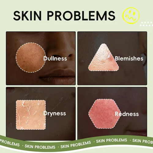 Vista 3 de QUIYUM Juego de Cuidado de la Piel de Frutas, 5 Productos de Rutina Diaria de Belleza y Cuidado de la Piel para Adolescentes - Juegos de Regalo