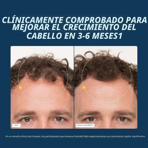 Vista 4 de Nutrafol Men's Hair Growth Supplements, Clinically Tested for Visibly Thicker Hair and Scalp Coverage, Dermatologist Recommended - 1 Month Supply, 1