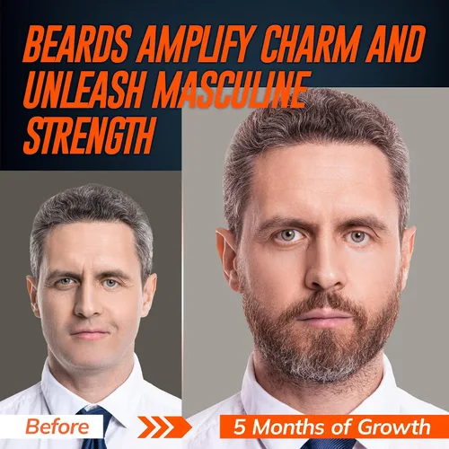 Vista 3 de RootStim 5% Minoxidil Beard Growth Serum for Men: 2-Pack Minoxidil Hair Regrowth Spray with Biotin & Rice Water - Extra Strength Beard Oil for