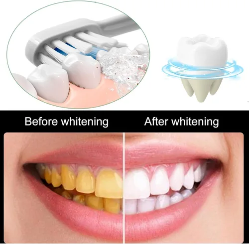 Vista 3 de Sp10 Probiotic Ultra Whitening Pasta de dientes (3 unidades)