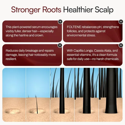 Vista 5 de FOLTENE Tratamiento para el crecimiento del cuero cabelludo y el cabello – Suero revitalizante para el crecimiento del cabello para hombres