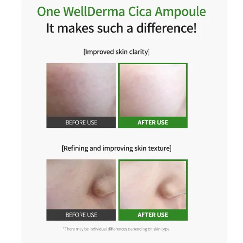 Vista 8 de WELLDERMA Tea Tree Herb Tox Cica Serum, 1.69 onzas líquidas – Suero facial hidratante y equilibrante con centella asiática, árbol de té y niacinamida