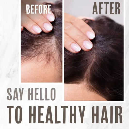 Vista 5 de Barra de acondicionador hialurónico y seco, acondicionador natural para el crecimiento, hidratante para cabello seco, desenredante para todo
