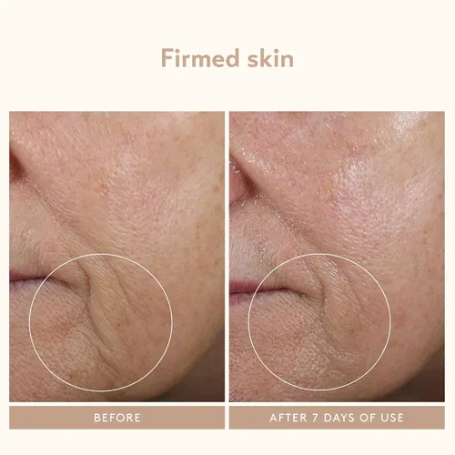 Vista 3 de SHANI DARDEN SKIN CARE - Varita para esculpir el rostro, dispositivo de reafirmación y apriete del cuello, dispositivo de ondas de sonido