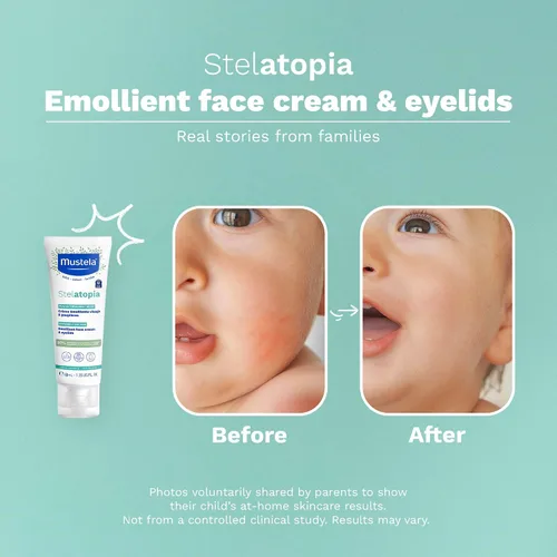 Vista 13 de Mustela Stelatopia Eczema - Crema facial emoliente para la piel del bebé, hidratante facial con aguacate natural y aceite de girasol, sin fragancia