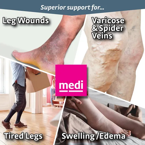 Vista 5 de mediven Plus for Men & Women, 40-50 mmHg, Thigh High w/Silicone Top-Band, Open Toe Standard-VII