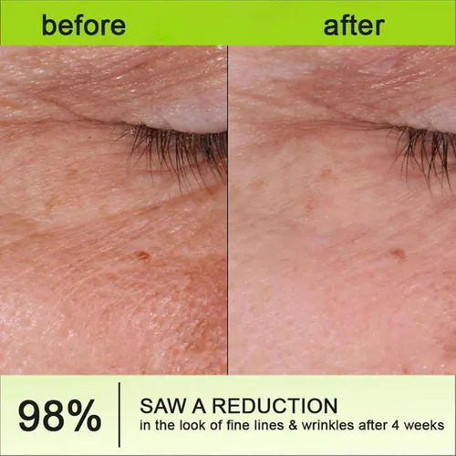 Vista 6 de Botoxmix & Vita-A Retinol Shot Crema de apriete para levantar arrugas, antiarrugas, minimizador de poros, líneas finas, toda la piel