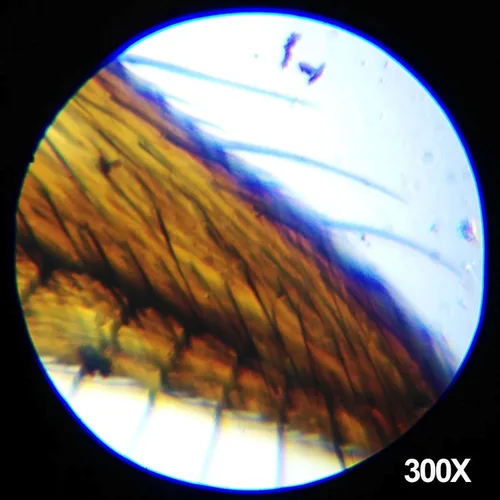 Vista 5 de AmScope Microscopio trinocular compuesto profesional digital T390B-3M, aumento 40X-2000X, oculares WF10x y WF20x, campo brillante, iluminación