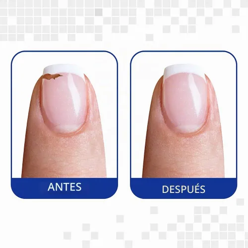 Vista 4 de Nail Tek Kit de Reparación de Uñas Kit de reparación de uñas para uñas rotas