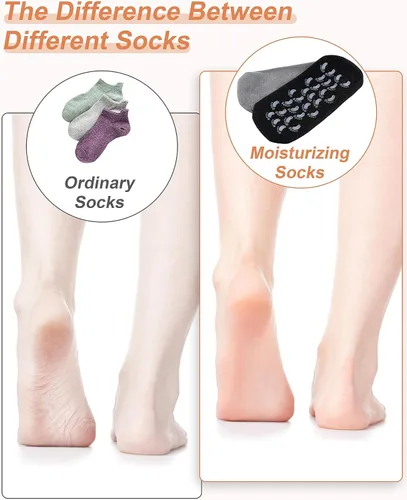 Vista 5 de Calcetines hidratantes, 2 pares de calcetines de loción para pies secos y agrietados para mujeres, calcetines hidratantes de pies, calcetines