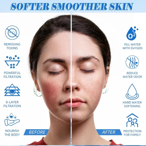 Vista 5 de Filtro de baño para bañera, filtro de agua de bañera para piel y cabello más suaves, filtro de agua de baño de filtración de grado hotelero de 8