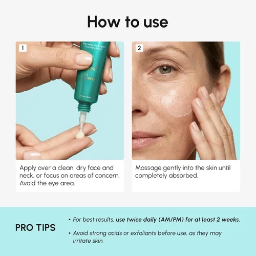 Vista 6 de MAREE Crema facial de ácido azelaico - Tratamiento de ácido azelaico con niacinamida y ácido salicílico - Corrector de manchas oscuras para la cara