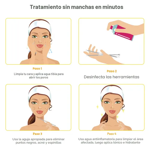 Vista 8 de Boxoyx - Kit de herramientas para reventar espinillas, kit de 10 piezas para eliminar puntos negros, kit extractor de comedones con caja