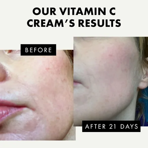 Vista 4 de Eclat Skincare Plump & Smooth - Crema hidratante facial con vitamina C y retinol crema hidratante facial de noche, 100% vegano y desarrollado por
