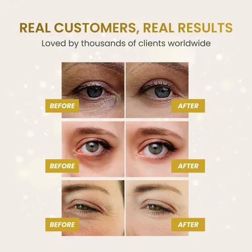Vista 4 de PLANTIFIQUE Parches para debajo de los ojos de oro de 24 quilates, 20 pares, probados por dermatólogos, mascarillas hidratantes de colágeno