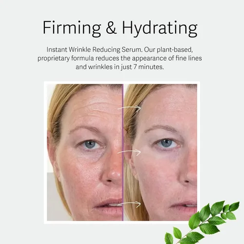 Vista 4 de Athena 7 Minute Lift - Crema de estiramiento facial instantáneo - Resultados en 7 minutos - Suero para tensar ojos, cuello, cara, levantamiento