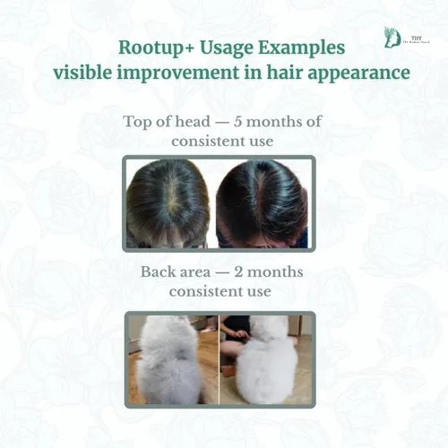 Vista 6 de [THY rootup+] Tónico botánico para el cabello, espray de hierbas para el cuero cabelludo para cabello de aspecto más completo, fórmula no grasa