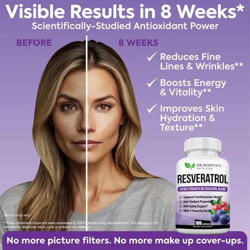Vista 4 de Resveratrol extra fuerte 1568mg - 180 cápsulas - 3 meses de suministro Suplemento antioxidante Pastillas naturales de trans-resveratrol