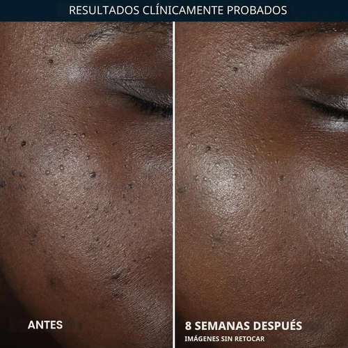 Vista 5 de RoC Multi Correxion 5 en 1 Crema Nocturna Restauradora, Antienvejecimiento para Cara con Hexinol, 1.7 Onzas (El Embalaje Puede Variar)