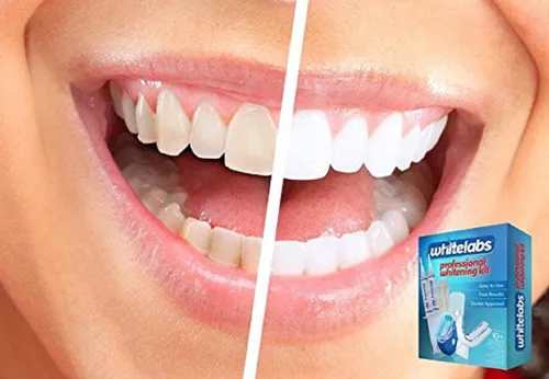 Vista 4 de Whitelabs At Home - Kit profesional de blanqueamiento dental