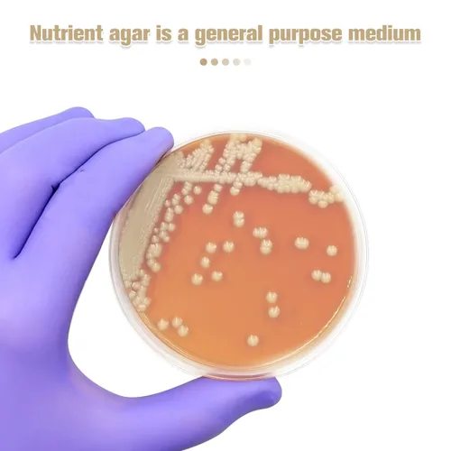 Vista 4 de ULTECHNOVO Platos de agar de dextrosa de patata, platos de agar de dextrosa prevertida PDA Petri - Excelente medio de crecimiento - Proyectos