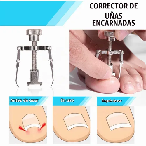 Vista 5 de Kit de eliminación de uñas encarnadas mejorado 2026, tratamiento de uñas encarnadas, corrector de uñas encarnadas de acero inoxidable, herramienta