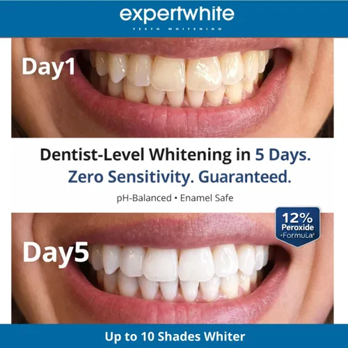 Vista 2 de MaxStrips™ Tiras blanqueadoras de dientes al 12% – Tiras blanqueadoras profesionales de peróxido al 12%, tecnología Dryfit antideslizante, seguro