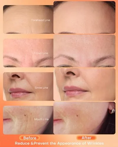 Vista 3 de NEWKEY Máscara de terapia de luz roja para cara, 7 colores LED máscara facial terapia de luz, fotón en casa cuidado de la piel máscara de belleza
