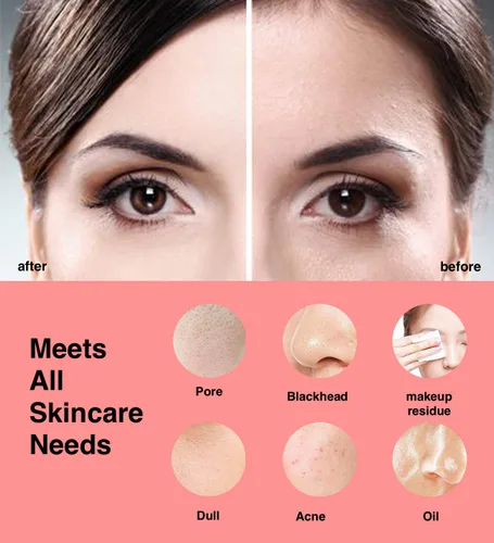 Vista 5 de NågraCoola CLIE Cepillo de limpieza facial, limpiador facial eléctrico impermeable y recargable para hombres y mujeres, exfoliante, masaje y Rosa