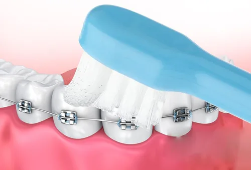 Vista 4 de WLLHYF 2 Piezas Cepillo de Dientes de Mechón Cabeza Pequeña Extremo Cónico Wisdom Interdental Interespacio Cuidado Suave Cepillo de Dientes Pequeño