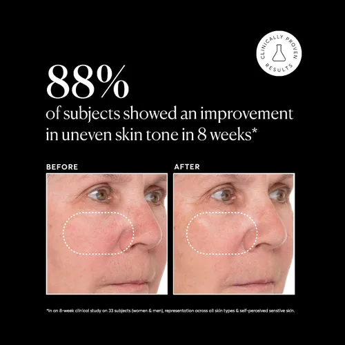 Vista 5 de Naturium Vitamin C Super Serum Plus, cuidado facial suavizante, más retinol, ácido hialurónico, niacinamida y ácido salicílico, 1 onza