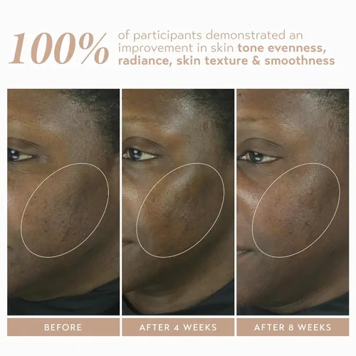 Vista 6 de SHANI DARDEN SKIN CARE Retinol Reform con suero de retinol encapsulado al 1% para cara y cuello, suave suero facial de retinol de liberación lenta