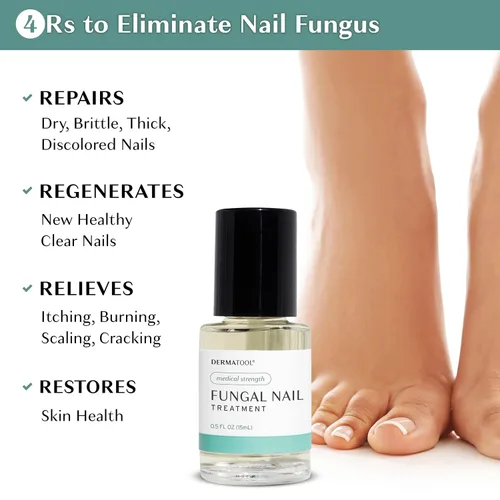 Vista 2 de Tratamiento de hongos en las uñas de los pies, solución antifúngica extra fuerte y tratamiento de hongos en las uñas de los pies – Repara uñas
