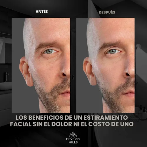 Vista 4 de Beverly Hills Tratamiento instantáneo de suero facial y suero para ojos para ojeras, ojos hinchados y arrugas