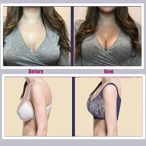 Vista 4 de Prettyhealth - Brasier de levantamiento potente y desintoxicación linfática