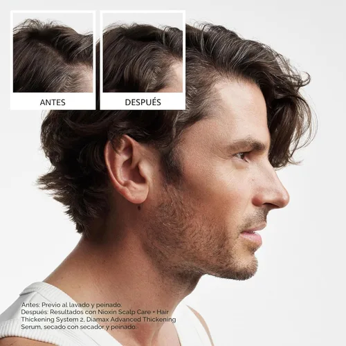 Vista 2 de Nioxin System 2 - Acondicionador de cuero cabelludo + engrosamiento del cabello para cabello natural con adelgazamiento progresado Aumenta