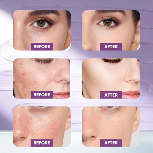 Vista 4 de Máscara facial de colágeno + suero PDRN de péptidos voluminosos, máscara hidrolizada para despegar durante la noche, juego de cuidado de la piel