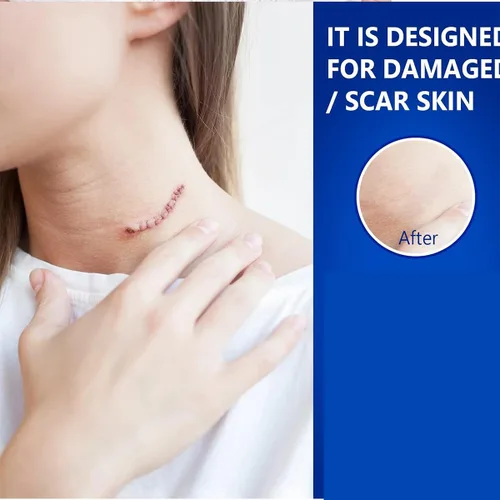 Vista 3 de Gel avanzado para cicatrices quirúrgicas, cara, cuerpo, piernas, quemaduras, acné, cesárea, estrías, queloides, eliminación eficaz de cicatrices