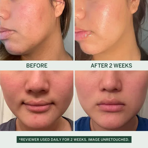 Vista 2 de FACETORY Urban Calm Soft Essence - Tónico para el cuidado de la piel hidratante, calmante e hidratante, tónico facial para pieles sensibles, grasas