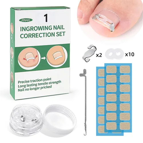 Vista 7 de Juego de herramientas de corrección de uñas encarnadas, 2 clips de inserción de acero inoxidable para tratamiento de uñas encarnadas, tiras