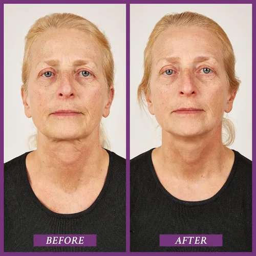 Vista 3 de PRAI Beauty Ageless - Suero de recuperación de caviar de garganta durante la noche para cuello sin edad al instante, suero reafirmante y tensor, 1.7