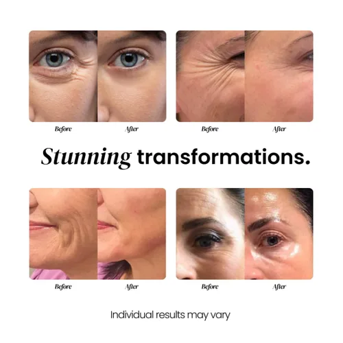 Vista 4 de Eliré Crema facial coreana antienvejecimiento con vitamina C y aloe - Hidratante reafirmante, hidratante y reparadora de arrugas - Piel sensible