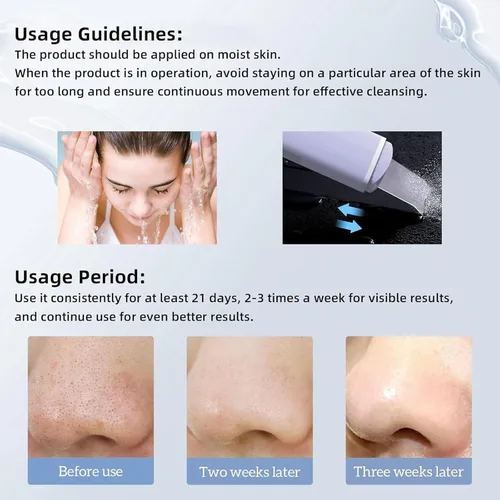 Vista 6 de GUGUG - Espátula para la piel, espátula facial, limpiador de poros, herramientas removedoras de puntos negros para limpieza profunda facial - 4