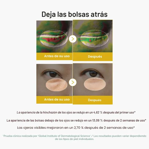 Vista 2 de medicube Eye Jelly Serum & Eye Cream Duo: suero de gel iluminador de ojos con ácido kójico y suero para ojos PDRN Piel iluminadora y de aspecto