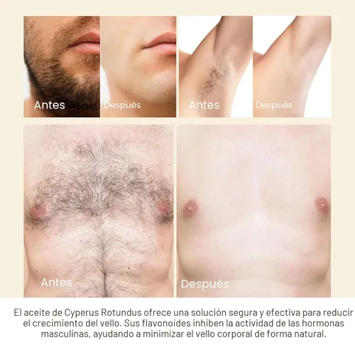 Vista 7 de Cyperus Aceite de reducción de cabello (paquete de 2) – Fórmula botánica natural para reducir el crecimiento no deseado del cabello, aceite corporal