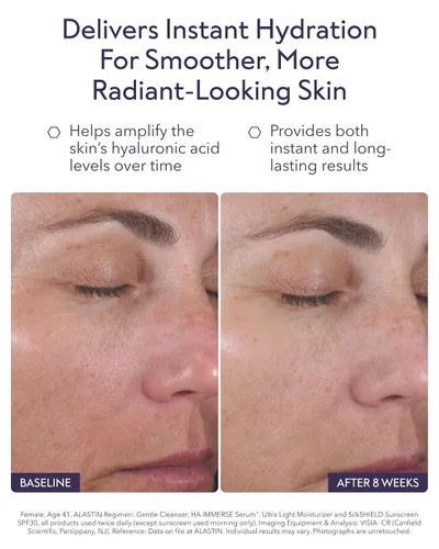 Vista 4 de ALASTIN Skincare Suero facial hidratante HA IMMERSE de ácido hialurónico (1 onza), suero restaurador que combate la piel seca y deshidratada