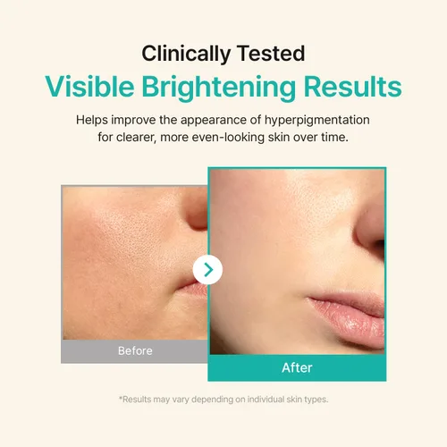 Vista 6 de ACWELL Licorice pH Balancing Advanced Facial Serum Ampolla – Cuidado de manchas oscuras y tonos desiguales con niacinamida, suero diario hidratante